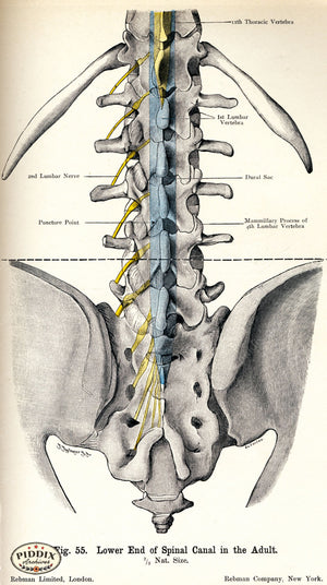 Pdxc7205 -- Human Anatomy Spine Color Illustration